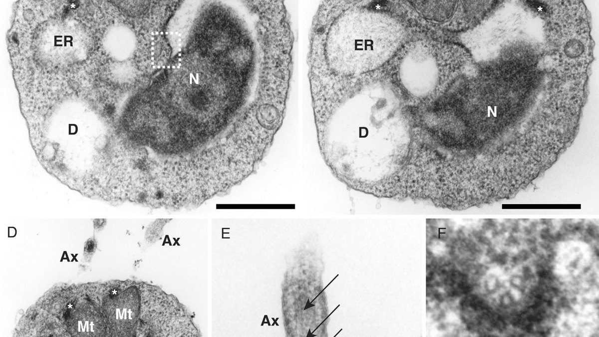 Mitochondria electron micrograph — where the NAD+/NADH couple powers cellular energy, the biochemistry behind Panacea Bio Chem PolyGluNAD by Bogdan Dicoias